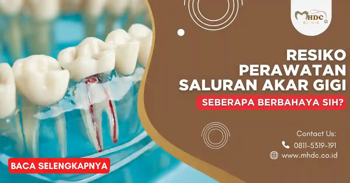resiko perawatan akar gigi