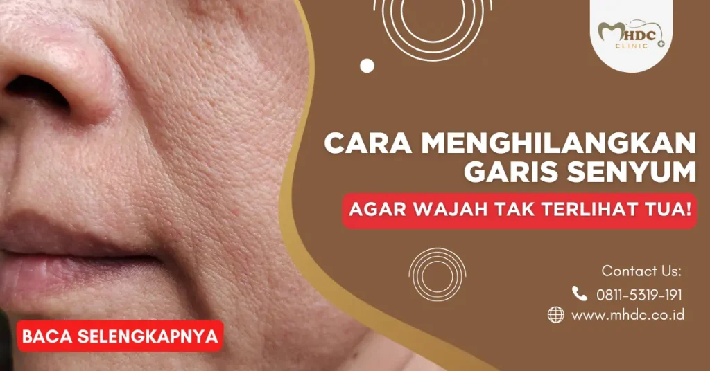 garis senyum
