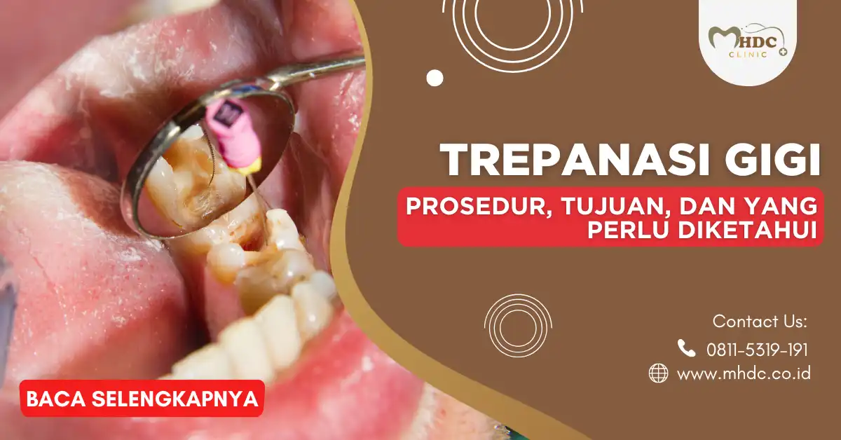 trepanasi gigi