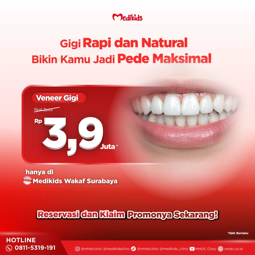 promo veneer gigi di surabaya