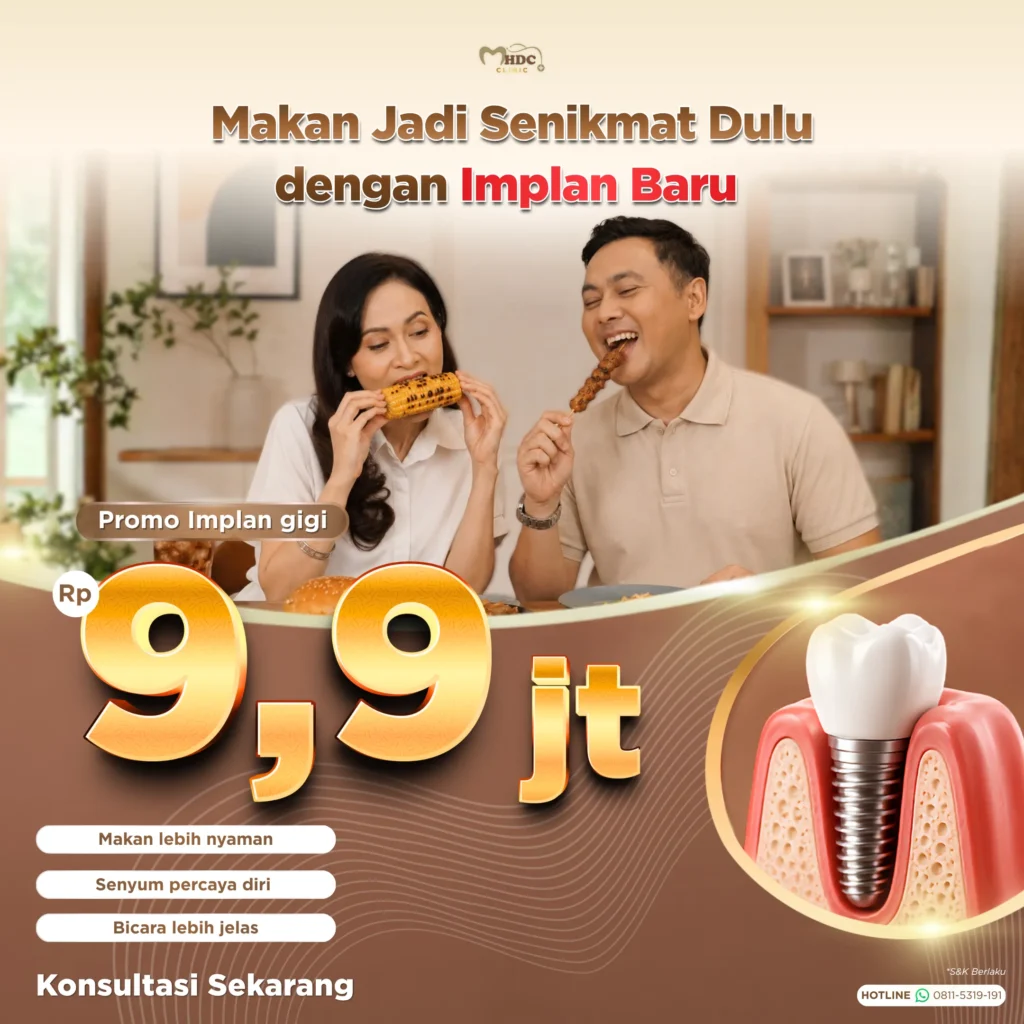 promo implan gigi harga spesial