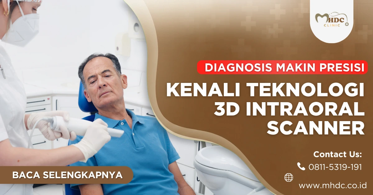 3D intraoral scanner