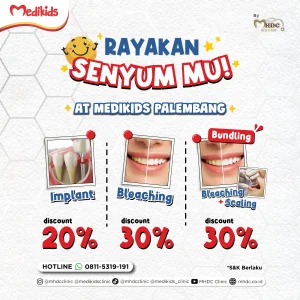 promo palembang