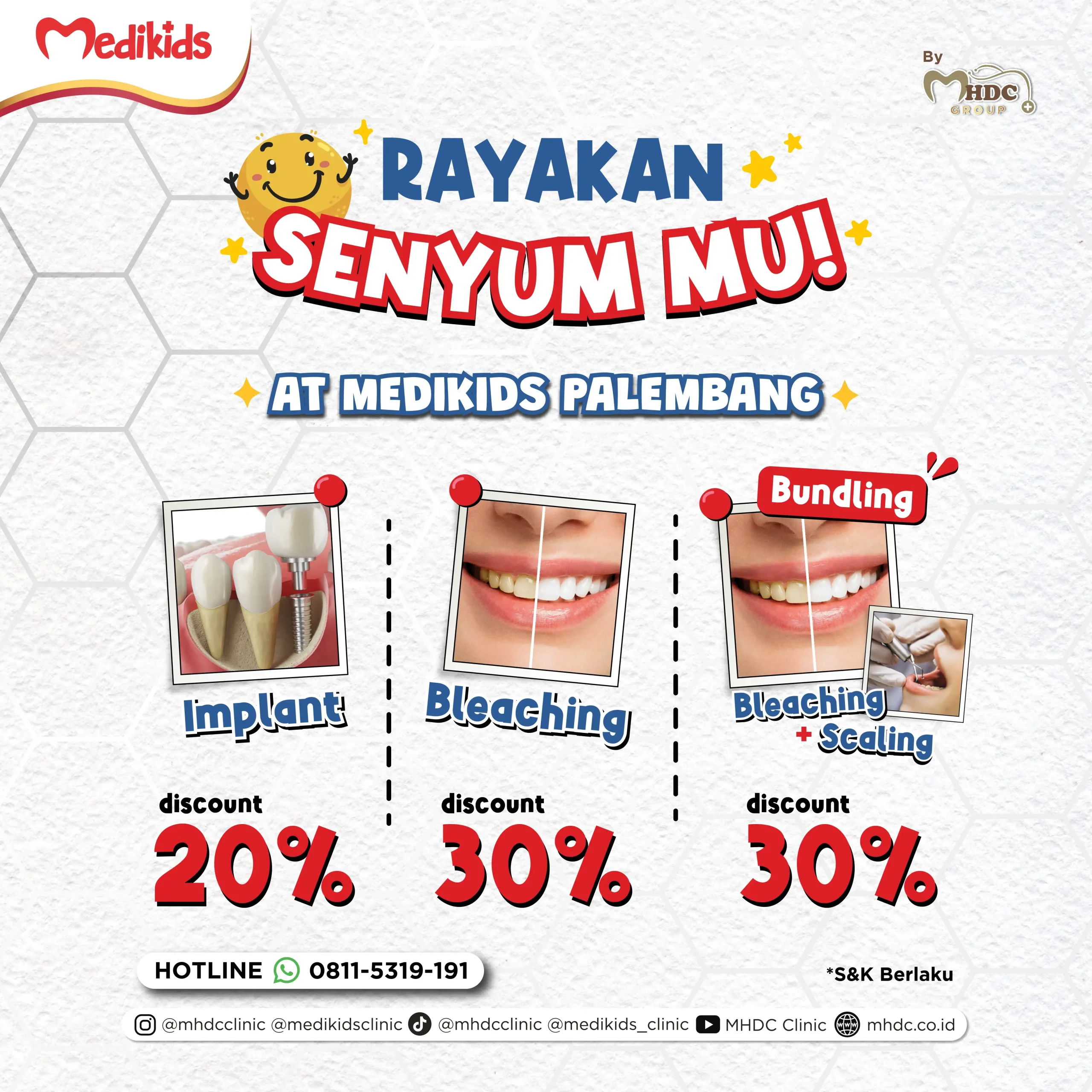 promo palembang